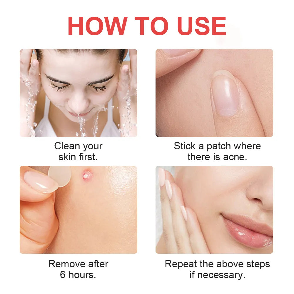 Mighty Patch Acne Patch