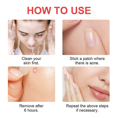 Mighty Patch Acne Patch