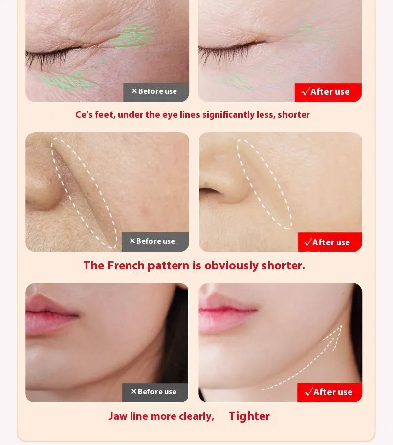 LED Light Therapy Facial Wand