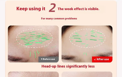 LED Light Therapy Facial Wand