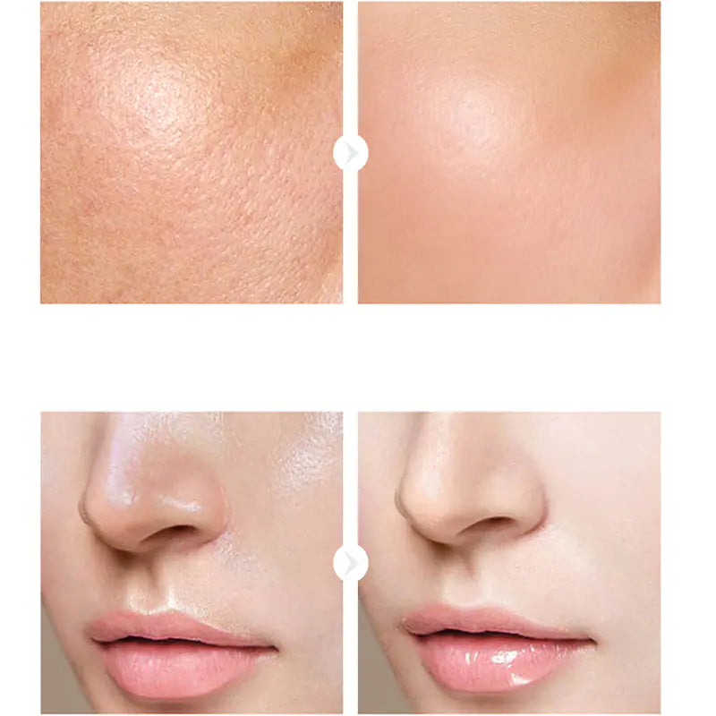 Hyaluronic Acid Serums