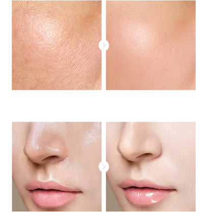 Hyaluronic Acid Serums